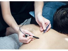 サロンロン 横浜関内(SALON RON)/硬毛化脱毛