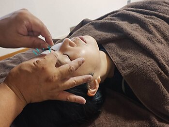 しまうら鍼灸院の写真/【目の奥までスッキリ◎】頭・首・目元を集中ケア☆完全個室なのでゆったりとリラックスしていただけます♪