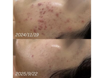 アンリミット 新宿三丁目店(Une limit)の写真