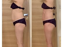 一度のbefore after肋骨・背中・ウエスト・ヒップもスッキリ。 