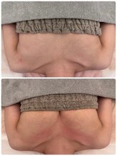 美人バスト 柏店/【バストアップ・育乳】症例