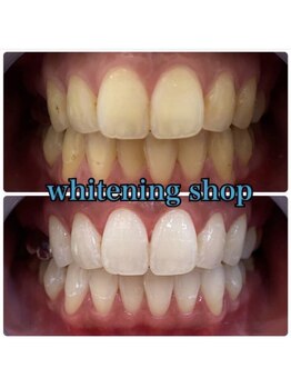 ホワイトニングショップ 大阪枚方店/セルフホワイトニング[大阪枚方]