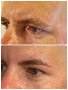 スリーピース(3Peace)/Before/After