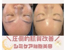 サロンツキ(salon tuki)