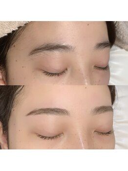 シャローム アローヴ(shalom alob)/【ハリウッドブロウリフト】