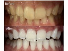THE GATE 武蔵小杉店の雰囲気（セルフホワイトニングで自然な白さを実感♪）