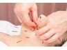 鍼施術30分+指圧20分 50分 ¥8800→¥6600
