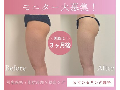 プリマルーチェの写真