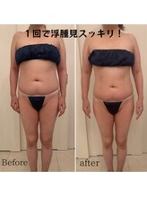 ソエルテ(soerute)/選べるマシン