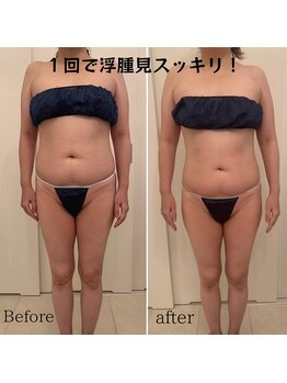 ソエルテ(soerute)/選べるマシン