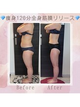 ビューティースタジオ エイワン(A1)/【痩身】Before ＆ After