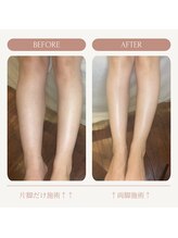 リンパ専門店 ファリンソ/リンパマッサージのBefore&After