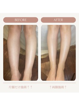 リンパ専門店 ファリンソ/リンパマッサージのBefore&After