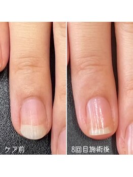 ネイルズ アヴァンティ(Nails Avanti)/自爪育成ネイルケア