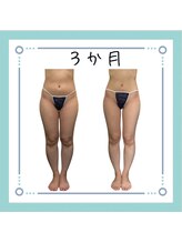 コンフィデンス 守口店(Confidence)/足もスッキリ細くなっちゃう♪