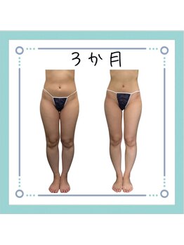 コンフィデンス 守口店(Confidence)/足もスッキリ細くなっちゃう♪