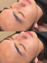 シアージュ(ciage.)/眉毛スタイリングワックス脱毛