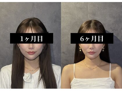 クリアランス 南青山(CLEARANCE)の写真