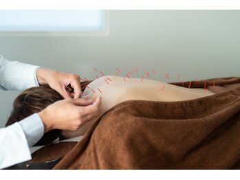 リケア 西新宿鍼灸院(reCare)/ハリミンハリケア