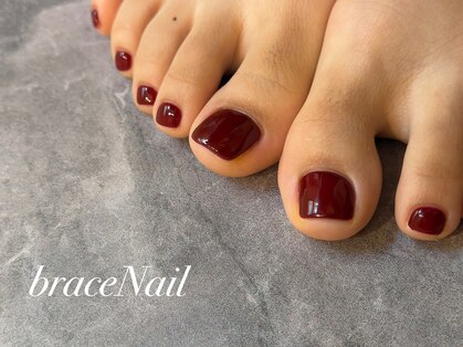 ブレスネイル(brace Nail)の写真