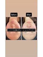 ニコノ(Nicono)/効果即実感