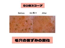 リアン(Lien)/50倍スコープ