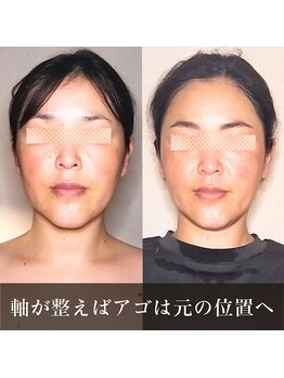 バンブー(bamboo)/キュッと引き締ったお顔立ち