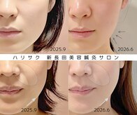 ハリサク