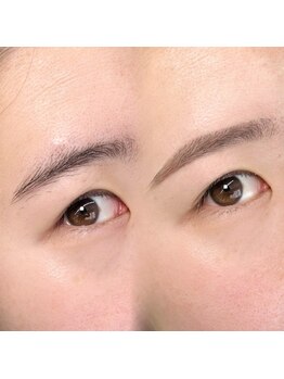 チルアンドアイ 千葉駅前店(Chill&Eye)/美眉スタイリング/BeforeAfter