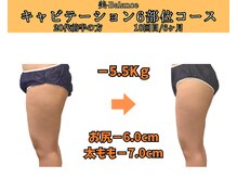 ビーバランス 本町店(美-Balance)/20代前半　月6部位コース