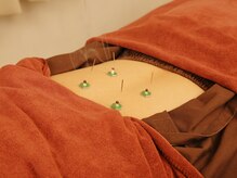 鍼灸マッサージ院 如月/鍼灸の実際の施術風景【鍼灸院】