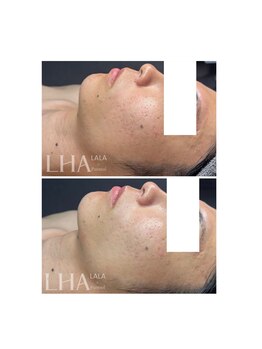 ピュアソル 奈良店(Puresol)/ララピール