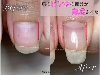 ナル(Nalu.)/ただ白い爪が伸びただけ?