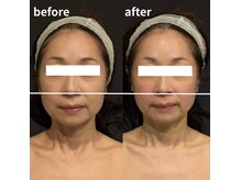 トリニティスペース(TrinitySpace)の雰囲気（プラズマ＆脂肪分解で驚きの小顔美肌！口コミを参考に☆）