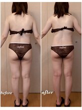 アンフィニ(infini)/短期集中コース5回（2ヶ月)