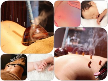 モミーズ(momii's)/マタニティ鍼灸/レディース鍼灸