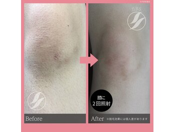 ビューティーボディ 名寄(The Beauty Body)/