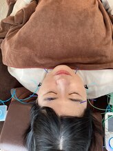 ハリファ鍼灸院 横浜関内院(HariFa鍼灸院)/美容施術