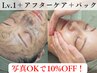 ■人気NO.1■ハーブピーリング[剥離なし約10回分の効果]ニキビケア/毛穴ケア