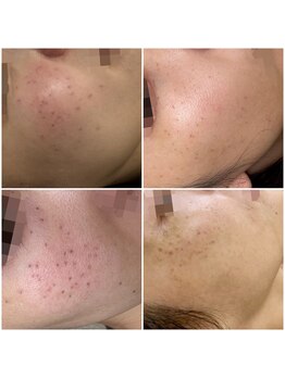 セメヴェール(Saimervell)/ご参考までに～♪