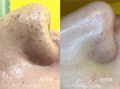 ミミーモリオカ(MiMiy MORIOKA)の写真