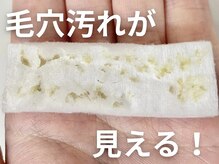 ラティエル(Latiele)の雰囲気（毛穴ケアでごっそり取れた汚れを見ることが出来ます！）