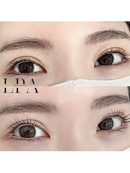 レピア 郡山駅前店/韓国式LEPIA Before&After