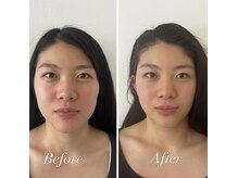 ムニ(muniii)の雰囲気（『眠らせる』ではなく『変えるため』のヘッドマッサージ）