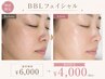 【初回限定】通常価格よりお得☆大人気☆ BBL美肌光フェイシャル