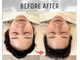 ノーブルルーム(noble room)の写真/Taptonetherapy/タップトーンセラピー たった一度の施術で自分史上最高の【別人級の小顔】に!!