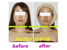 ボディグロス 梅田店(BODY GLOSS)の雰囲気（小顔と美肌の【セレブエイジング】もデコルテネック込で大人気！）