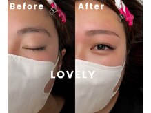 アリイ(Alii)/Lovely