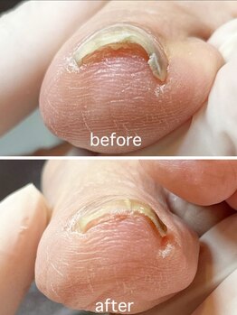 リネイル 長浜(Re-na-iL)/【今だけ】無料相談