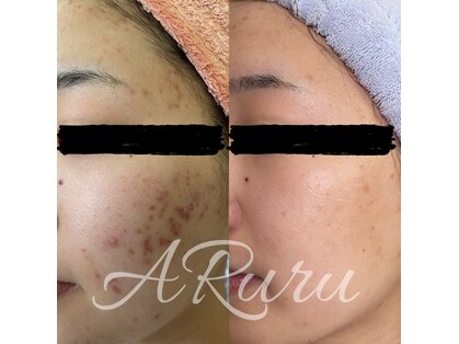 アルルプラス 南草津(ARuru+)の写真
